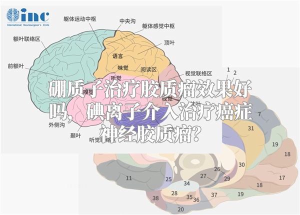 硼质子治疗胶质瘤效果好吗，碘离子介入治疗癌症神经胶质瘤？