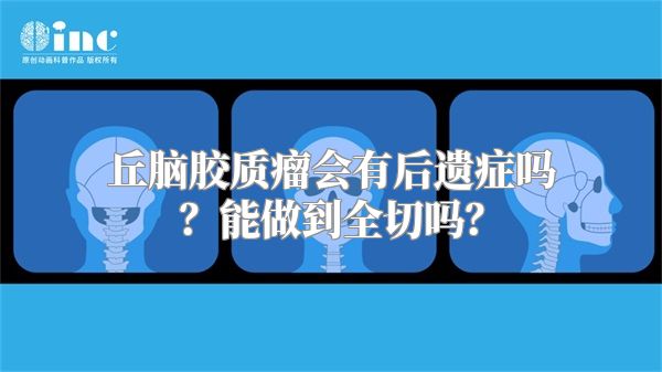 丘脑胶质瘤会有后遗症吗？能做到全切吗？