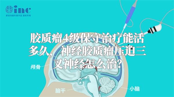 胶质瘤4级保守治疗能活多久，神经胶质瘤压迫三叉神经怎么治？