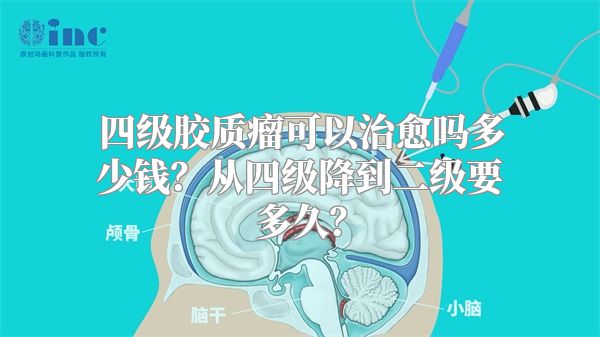 四级胶质瘤可以治愈吗多少钱？从四级降到二级要多久？