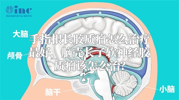 手指根长胶质瘤怎么治疗最好，脑壳长了软神经胶质瘤该怎么治？