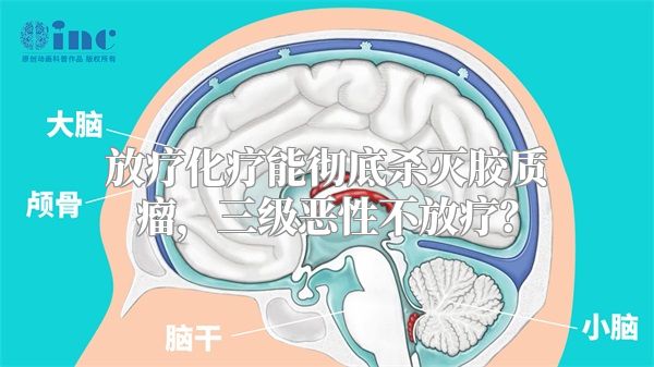 放疗化疗能彻底杀灭胶质瘤，三级恶性不放疗？