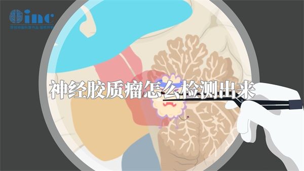 神经胶质瘤怎么检测出来