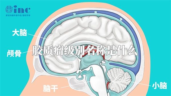 胶质瘤级别名称是什么