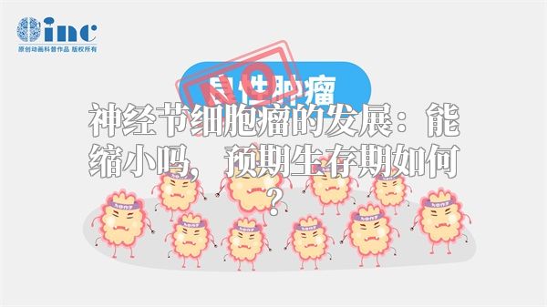 神经节细胞瘤的发展：能缩小吗，预期生存期如何？