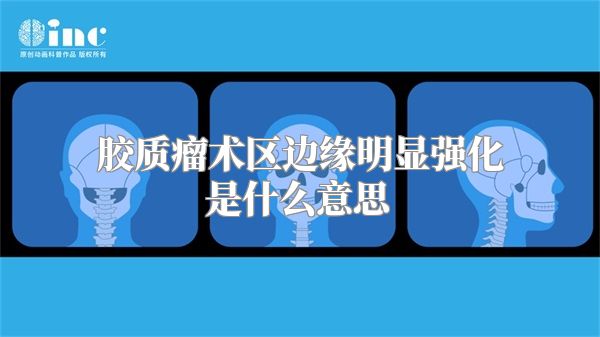 胶质瘤术区边缘明显强化是什么意思