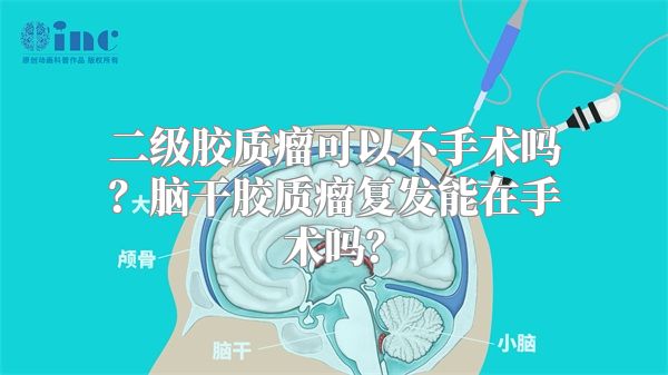 二级胶质瘤可以不手术吗？脑干胶质瘤复发能在手术吗？