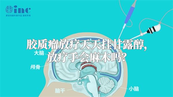 胶质瘤放疗天天挂甘露醇，放疗手会麻木吗？