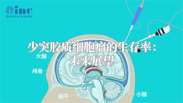 少突胶质细胞瘤的生存率：未来展望