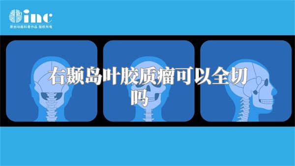 右颞岛叶胶质瘤可以全切吗    