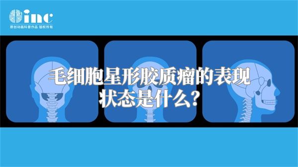 毛细胞星形胶质瘤的表现状态是什么？