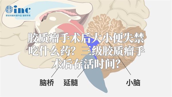 胶质瘤手术后大小便失禁吃什么药？三级胶质瘤手术后存活时间？