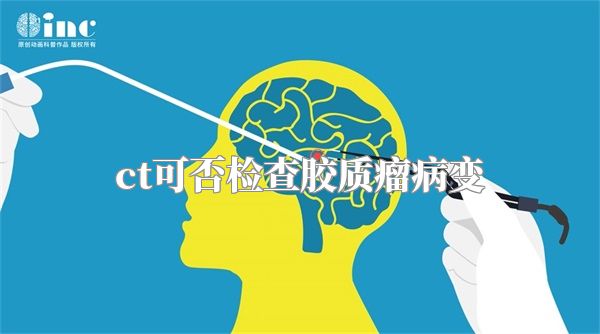 ct可否检查胶质瘤病变