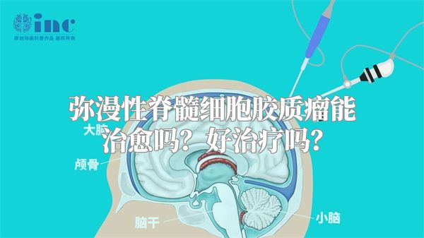 弥漫性脊髓细胞胶质瘤能治愈吗？好治疗吗？