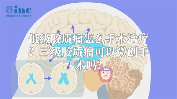 低级胶质瘤怎么手术治疗？三级胶质瘤可以微创手术吗？