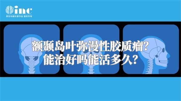 额颞岛叶弥漫性胶质瘤？能治好吗能活多久？