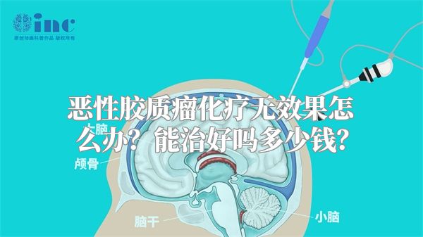 恶性胶质瘤化疗无效果怎么办？能治好吗多少钱？