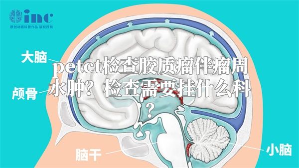 petct检查胶质瘤伴瘤周水肿？检查需要挂什么科？