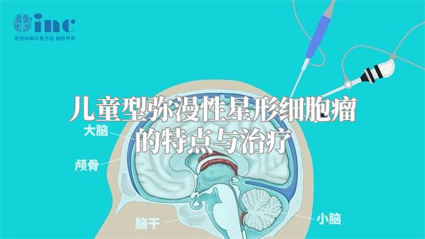 儿童型弥漫性星形细胞瘤的特点与治疗