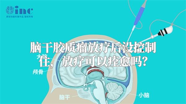 脑干胶质瘤放疗后没控制住，放疗可以痊愈吗？