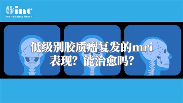 低级别胶质瘤复发的mri表现？能治愈吗？