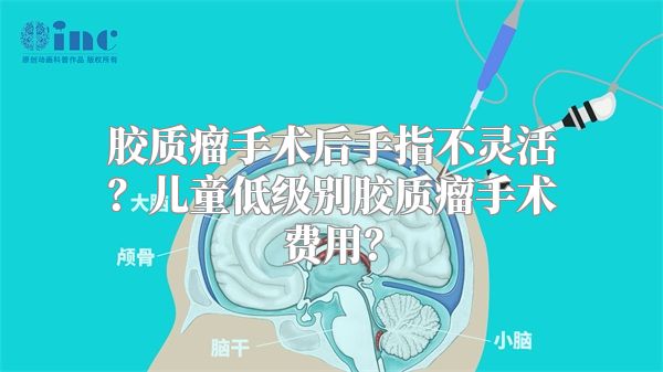 胶质瘤手术后手指不灵活？儿童低级别胶质瘤手术费用？