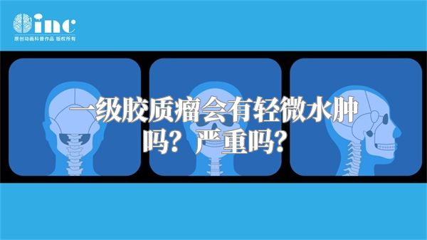 一级胶质瘤会有轻微水肿吗？严重吗？