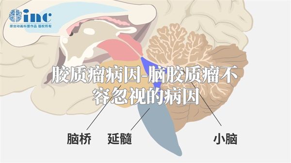 胶质瘤病因-脑胶质瘤不容忽视的病因