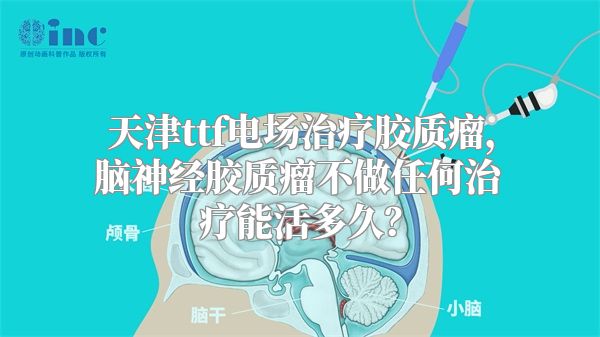 天津ttf电场治疗胶质瘤，脑神经胶质瘤不做任何治疗能活多久？