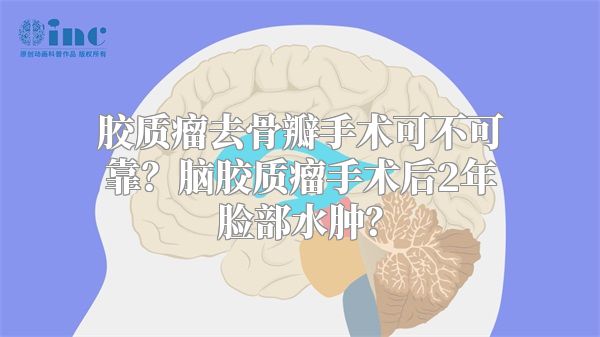 胶质瘤去骨瓣手术可不可靠？脑胶质瘤手术后2年脸部水肿？