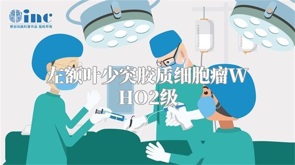 左额叶少突胶质细胞瘤WHO2级