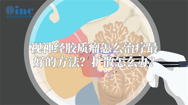 视神经胶质瘤怎么治疗最好的方法？扩散怎么办？