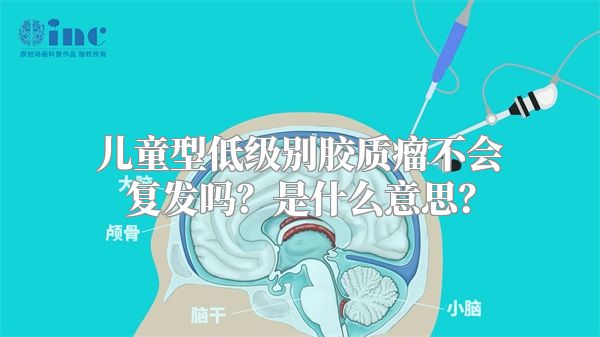 儿童型低级别胶质瘤不会复发吗？是什么意思？