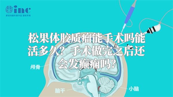 松果体胶质瘤能手术吗能活多久？手术做完之后还会发癫痫吗？