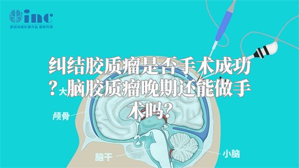 纠结胶质瘤是否手术成功？脑胶质瘤晚期还能做手术吗？