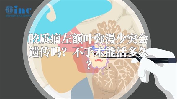 胶质瘤左额叶弥漫少突会遗传吗？不手术能活多久？