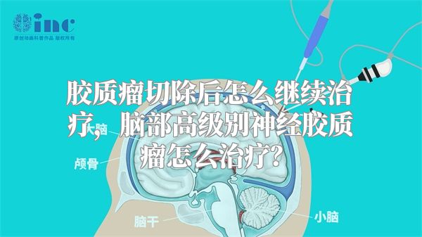 胶质瘤切除后怎么继续治疗，脑部高级别神经胶质瘤怎么治疗？