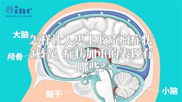 怎样让人患上胶质瘤症状减轻？症状加重的表现有哪些？