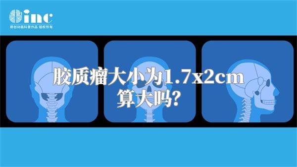 胶质瘤大小为1.7x2cm算大吗？