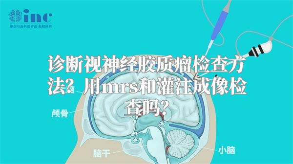 诊断视神经胶质瘤检查方法？用mrs和灌注成像检查吗？