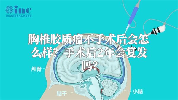 胸椎胶质瘤不手术后会怎么样？手术后2年会复发吗？