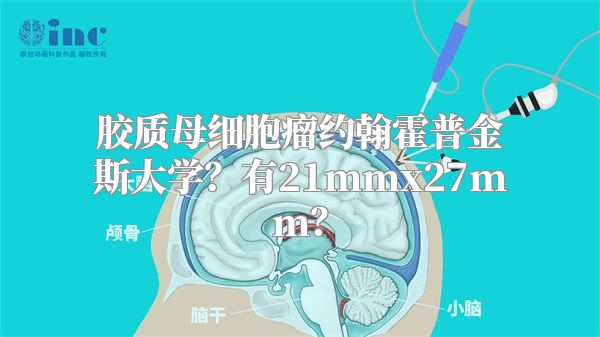 胶质母细胞瘤约翰霍普金斯大学？有21mmx27mm？