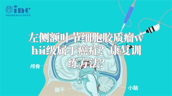 左侧额叶节细胞胶质瘤whii级属于癌症？康复训练方法？