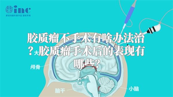 胶质瘤不手术有啥办法治？胶质瘤手术后的表现有哪些？