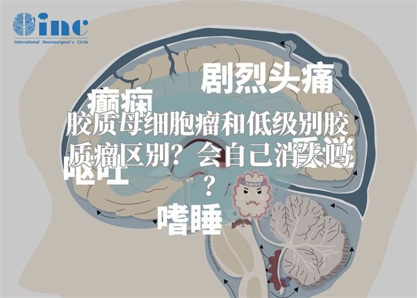 胶质母细胞瘤和低级别胶质瘤区别？会自己消失吗？