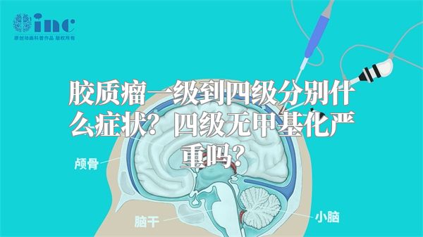 胶质瘤一级到四级分别什么症状？四级无甲基化严重吗？