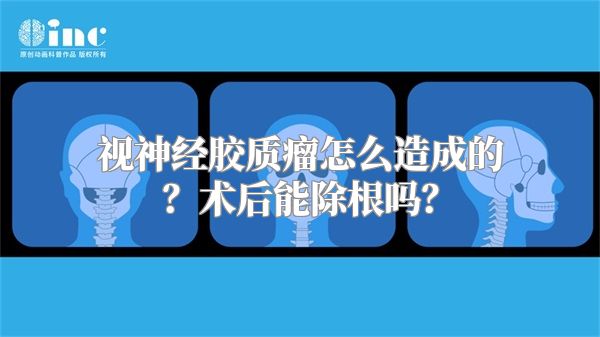 视神经胶质瘤怎么造成的？术后能除根吗？