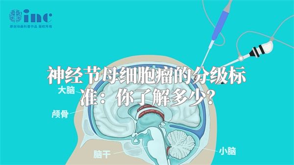 神经节母细胞瘤的分级标准：你了解多少？