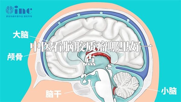 中医看脑胶质瘤哪里好一点