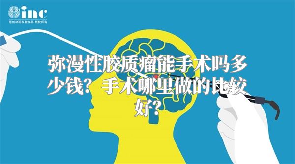 弥漫性胶质瘤能手术吗多少钱？手术哪里做的比较好？